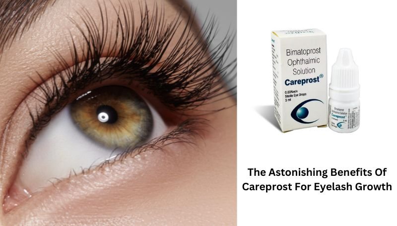 The Astonishing Benefits Of Careprost For Eyelash Growth